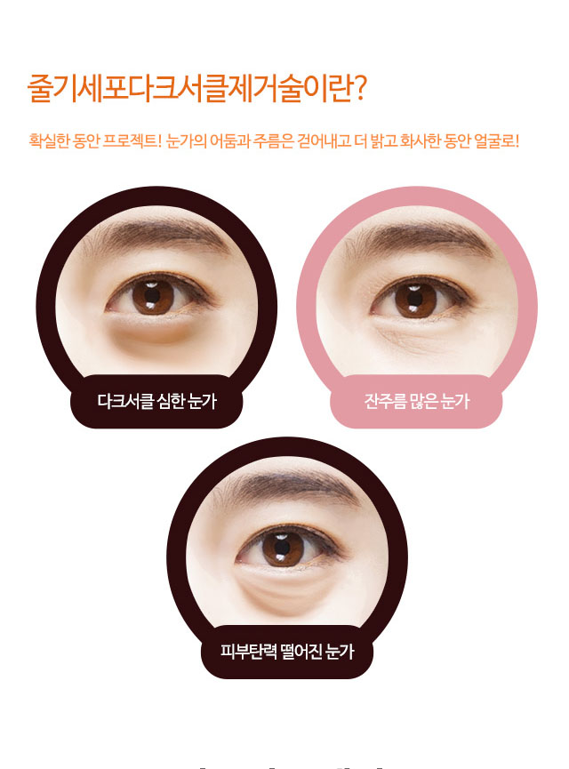줄기세포다크서클제거술이란?
확실한 동안 프로젝트! 눈가의 어둠과 주름은 걷어내고 더 밝고 화사한 동안 얼굴로!
다크서클 심한 눈가
잔주름 많은 눈가
피부탄력 떨어진 눈가