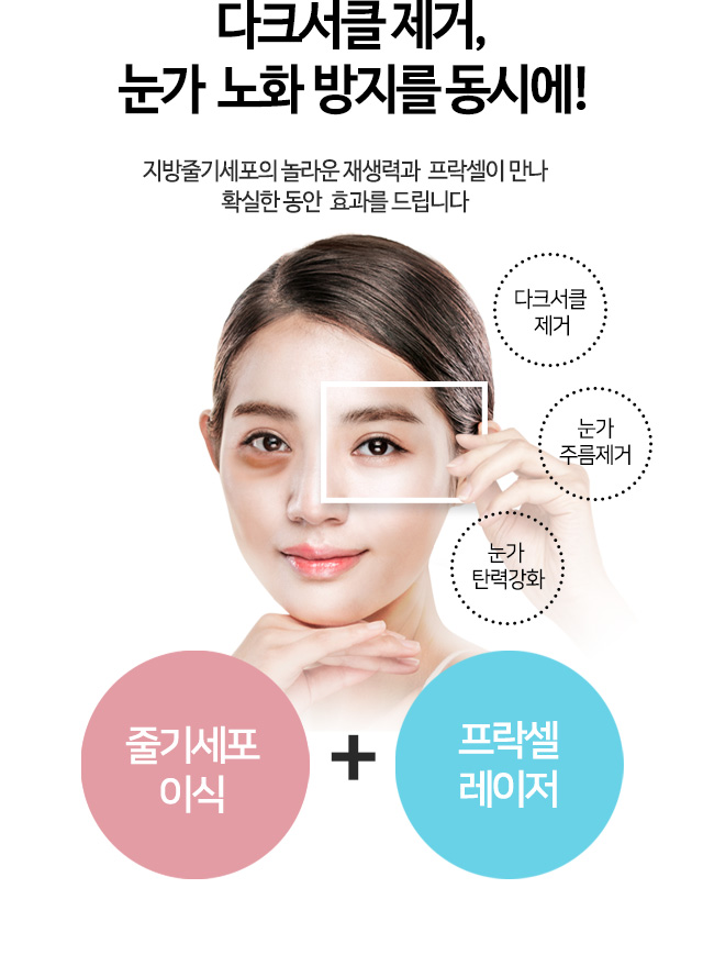 다크서클 제거, 눈가 노화 방지를 동시에!
지방줄기세포의 놀라운 재생력과 프락셀이 만나 확실한 동안 효과를 드립니다
줄기세포 이식 + 프락셀 레이저