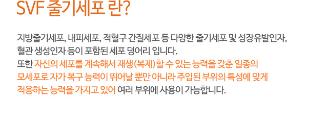 SVF 줄기세포 란?
지방줄기세포, 내피세포, 적혈구 간질세포 등 다양한 줄기세포 및 성장유발인자,
혈관 생성인자 등이 포함된 세포 덩어리 입니다.
또한 자신의 세포를 계속해서 재생(복제)할 수 있는 능력을 갖춘 일종의
모세포로 자가 복구 능력이 뛰어날 뿐만 아니라 주입된 부위의 특성에 맞게
적응하는 능력을 가지고 있어 여러 부위에 사용이 가능합니다.