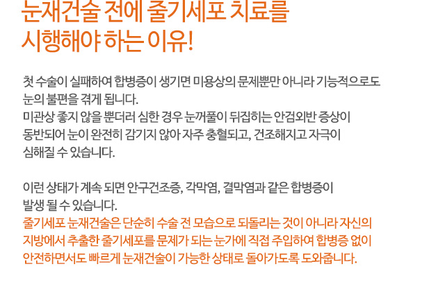 눈재건술 전에 줄기세포 치료를 시행해야 하는 이유!
첫 수술이 실패하여 합병증이 생기면 미용상의 문제뿐만 아니라 기능적으로도
눈의 불편을 겪게 됩니다.
미관상 좋지 않을 뿐더러 심한 경우 눈꺼풀이 뒤집히는 안검외반 증상이
동반되어 눈이 완전히 감기지 않아 자주 충혈되고, 건조해지고 자극이
심해질 수 있습니다.
이런 상태가 계속 되면 안구건조증, 각막염, 결막염과 같은 합병증이
발생 될 수 있습니다.
줄기세포 눈재건술은 단순히 수술 전 모습으로 되돌리는 것이 아니라 자신의
지방에서 추출한 줄기세포를 문제가 되는 눈가에 직접 주입하여 합병증 없이
안전하면서도 빠르게 눈재건술이 가능한 상태로 돌아가도록 도와줍니다.