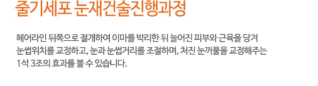 줄기세포 눈재건술진행과정
헤어라인 뒤쪽으로 절개하여 이마를 박리한 뒤 늘어진 피부와 근육을 당겨
눈썹위치를 교정하고, 눈과 눈썹거리를 조절하며, 처진 눈꺼풀을 교정해주는
1석 3조의 효과를 볼 수 있습니다.