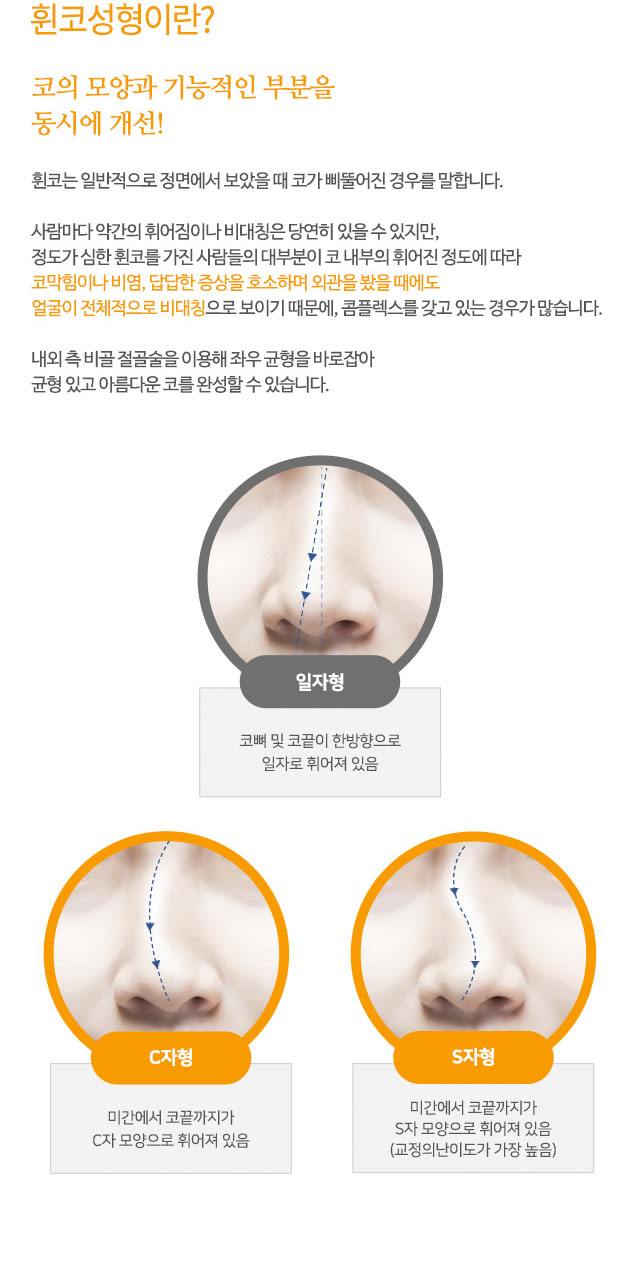 휜코성형이란? 코의 모양과 기능적인 부분을
동시에 개선!
휜코는 일반적으로 정면에서 보았을 때 코가 삐뚤어진 경우를 말합니다.
사람마다 약간의 휘어짐이나 비대칭은 당연히 있을 수 있지만,
정도가 심한 휜코를 가진 사람들의 대부분이 코 내부의 휘어진 정도에 따라
코막힘이나 비염, 답답한 증상을 호소하며 외관을 봤을 때에도
얼굴이 전체적으로 비대칭으로 보이기 때문에, 콤플렉스를 갖고 있는 경우가 많습니다.
내외 측 비골 절골술을 이용해 좌우 균형을 바로잡아
균형 있고 아름다운 코를 완성할 수 있습니다.