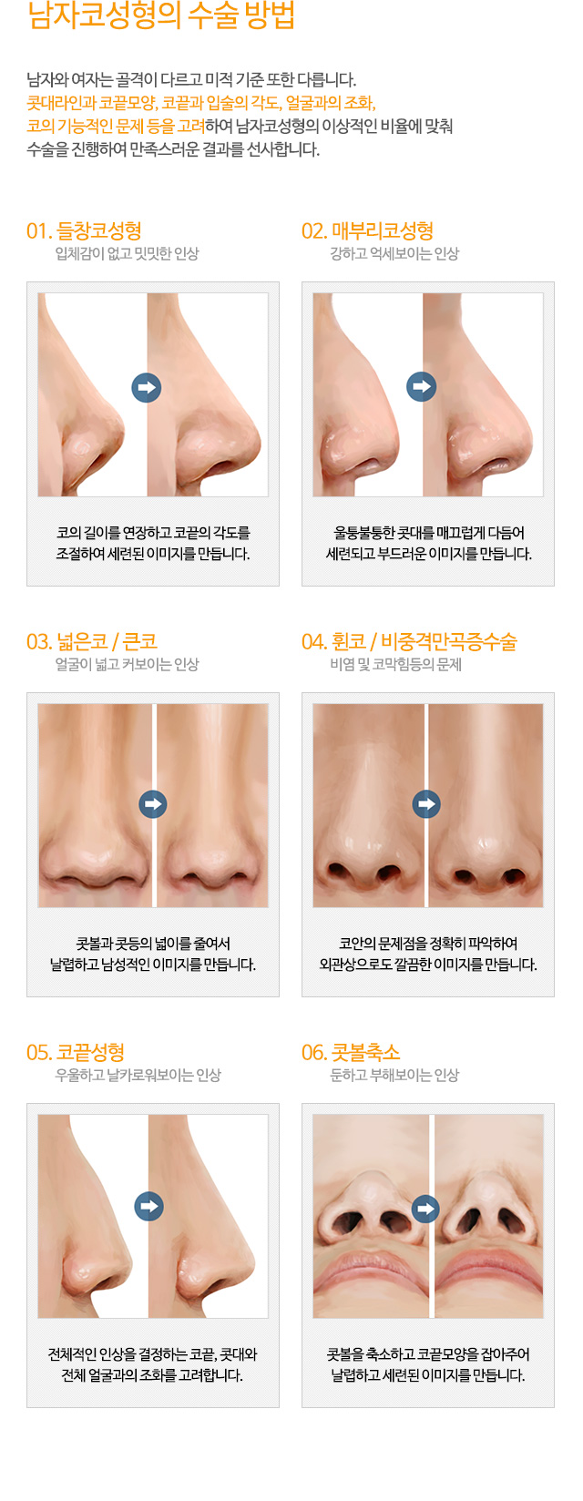 남자코성형의 수술 방법
남자와 여자는 골격이 다르고 미적 기준 또한 다릅니다.
콧대라인과 코끝모양, 코끝과 입술의 각도, 얼굴과의 조화,
코의 기능적인 문제 등을 고려하여 남자코성형의 이상적인 비율에 맞춰
수술을 진행하여 만족스러운 결과를 선사합니다.