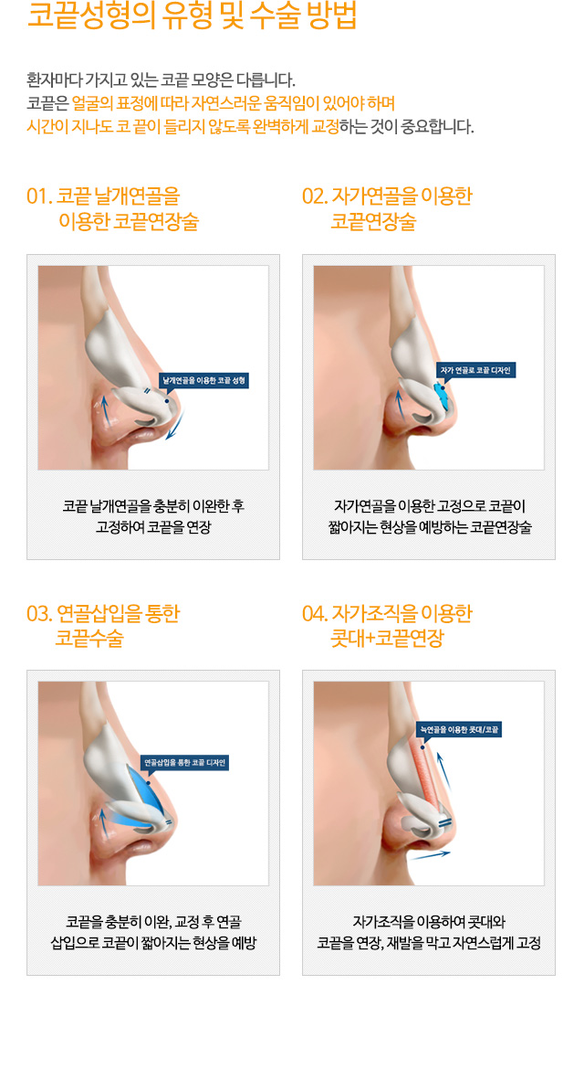 코끝성형의 유형 및 수술 방법
환자마다 가지고 있는 코끝 모양은 다릅니다.
코끝은 얼굴의 표정에 따라 자연스러운 움직임이 있어야 하며
시간이 지나도 코 끝이 들리지 않도록 완벽하게 교정하는 것이 중요합니다.