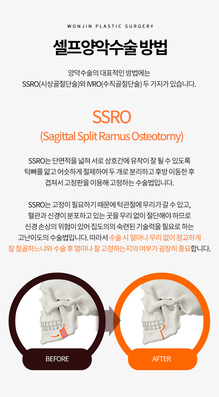 셀프양악수술 방법
		양악수술의 대표적인 방법에는 SSRO(시상골절단술)와 IVRO(수직골절단술) 두 가지가 있습니다.
		SSRO (Sagittal Split Ramus Osteotomy)
		SSRO는 단면적을 넓혀 서로 상호간에 유착이 잘 될 수 있도록 턱뼈를 얇고 어슷하게 절제하여
		두 개로 분리하고 후방 이동한 후 겹쳐서 고정판을 이용해 고정하는 수술법입니다.

		SSRO는 고정이 필요하기 때문에 턱관절에 무리가 갈 수 있고, 혈관과 신경이 분포하고 있는 곳을
		무리 없이 절단해야 하므로 신경 손상의 위험이 있어 집도의의 숙련된 기술력을 필요로 하는 고난이도의 수술법입니다.
		따라서 수술 시 얼마나 무리 없이 정교하게 잘 절골하느냐와 수술 후 얼마나 잘 고정하는지의 여부가 굉장히 중요합니다.
