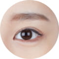 눈 성형 이미지