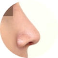 코 성형 이미지