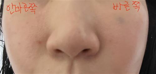 이미지 1