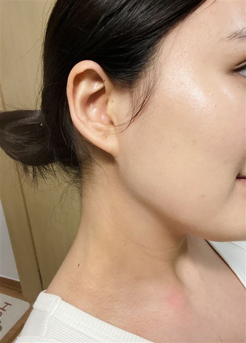 이미지 1