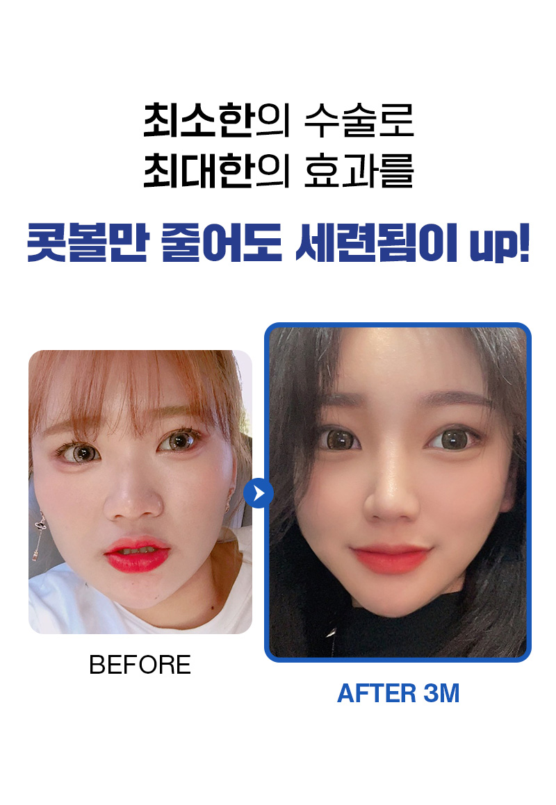 광고랜딩