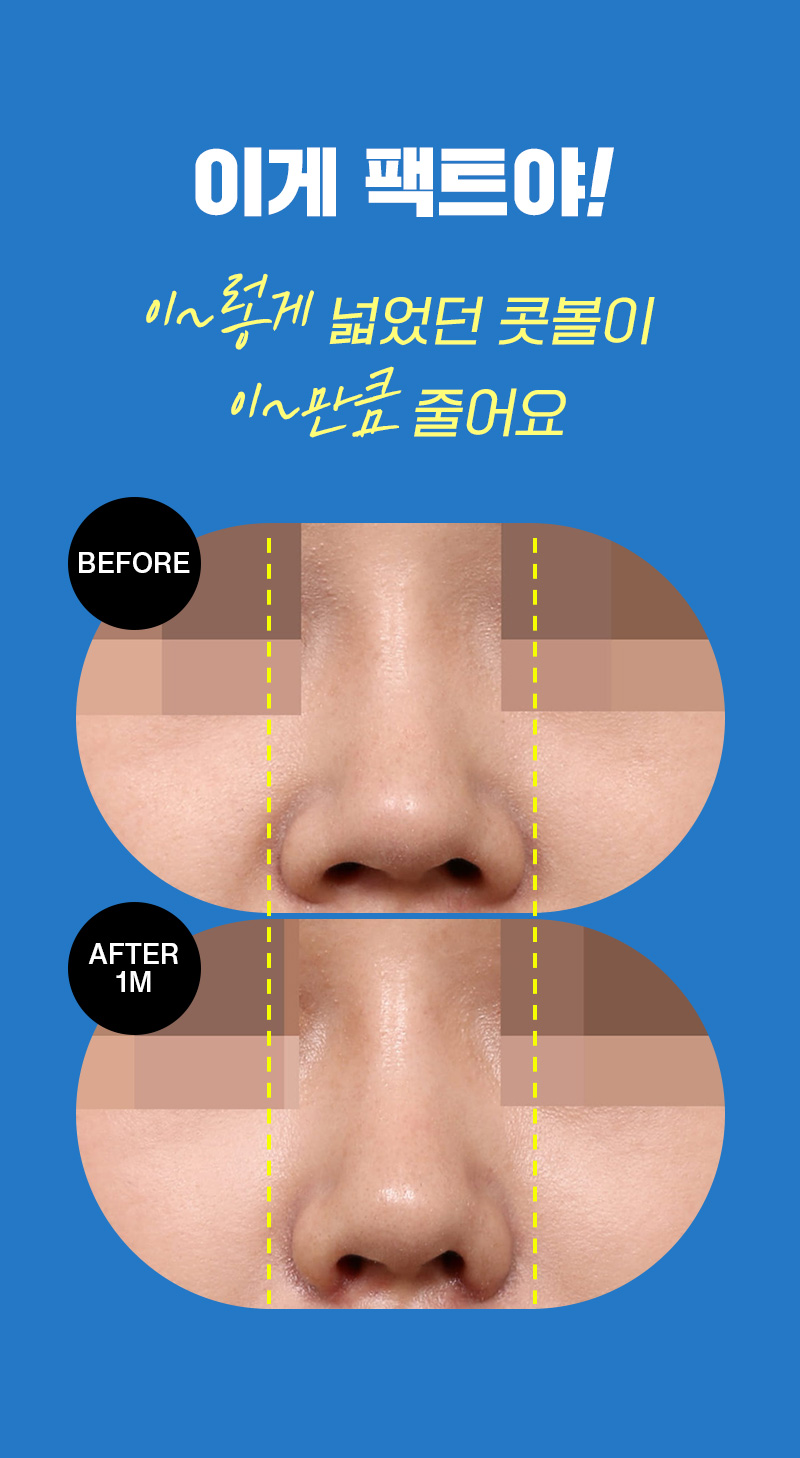 광고랜딩