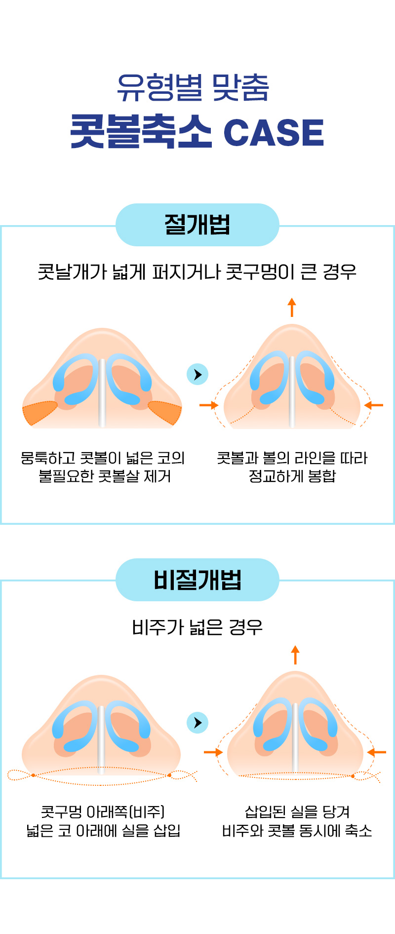 광고랜딩