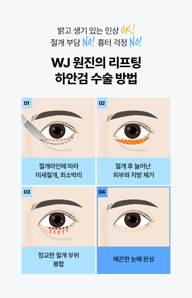 광고랜딩