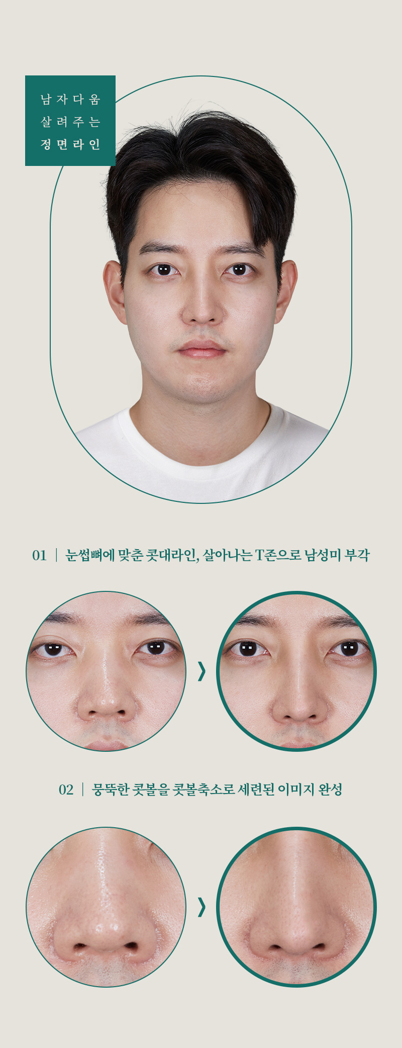 광고랜딩