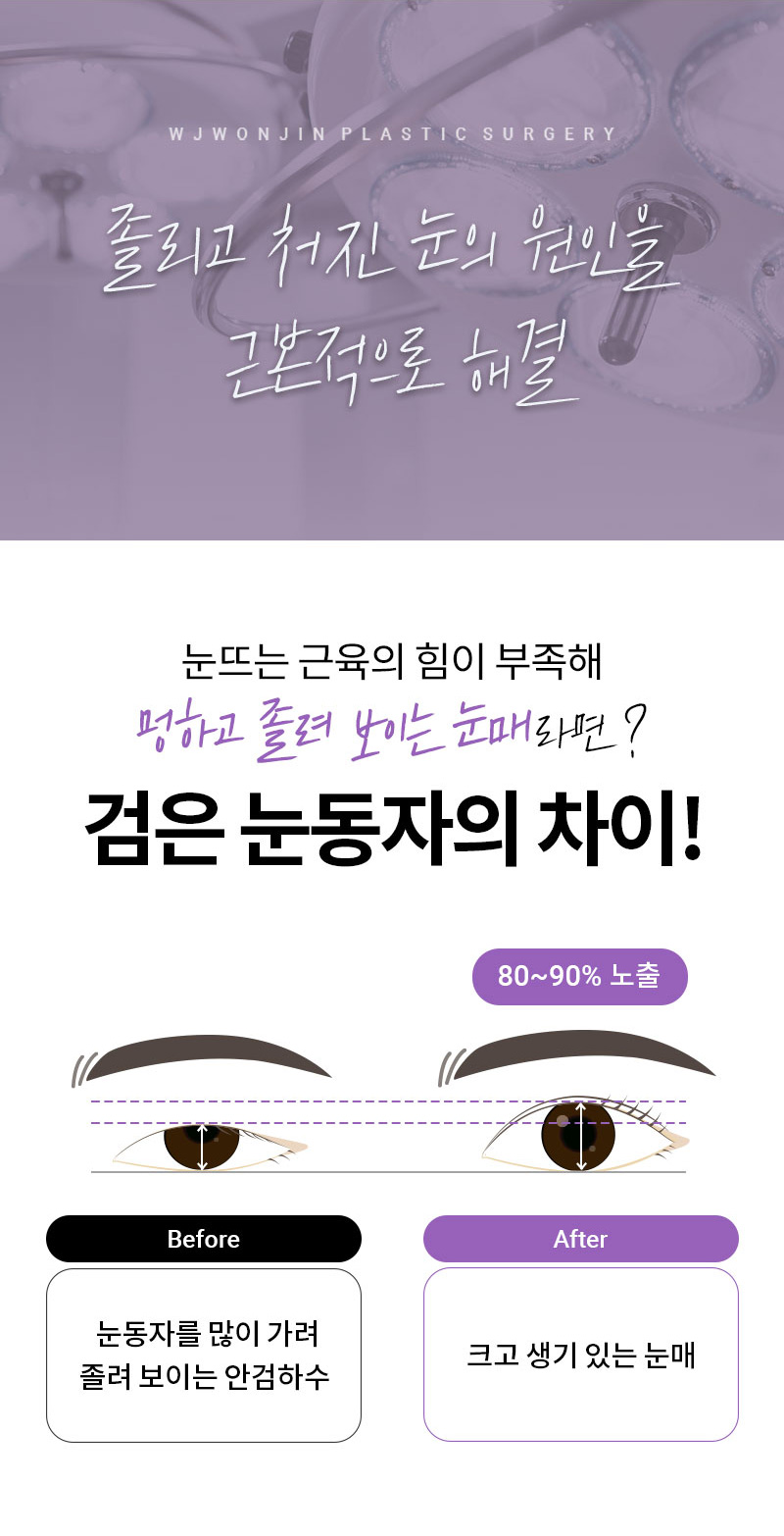 광고랜딩