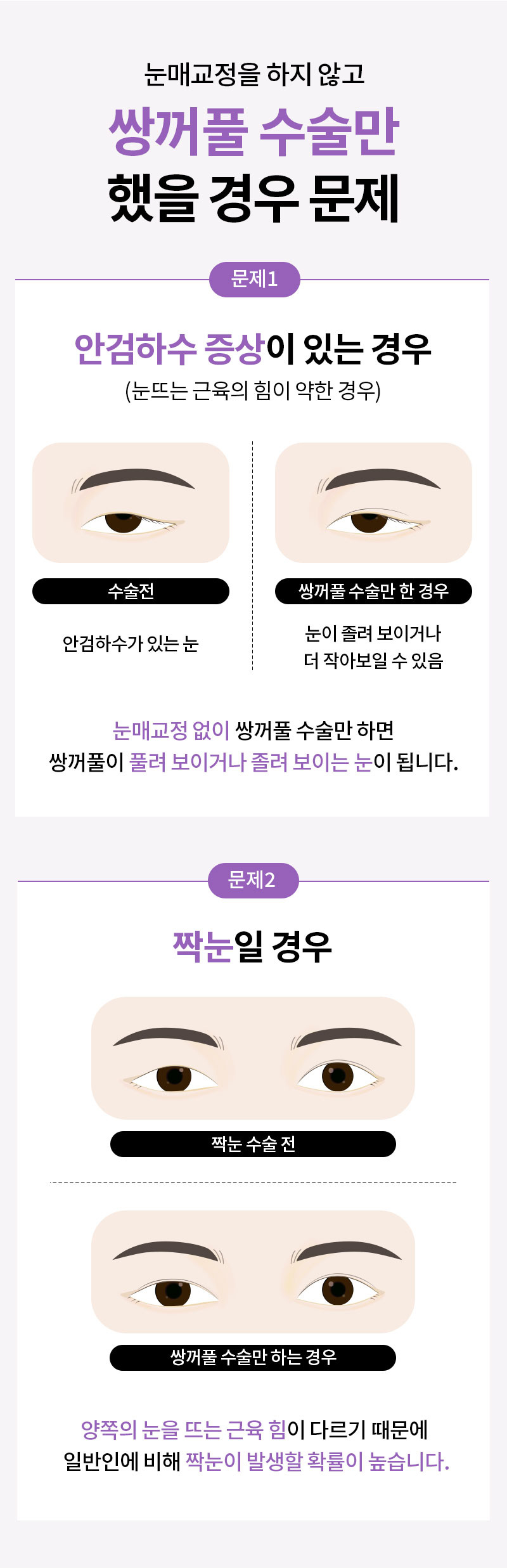 광고랜딩
