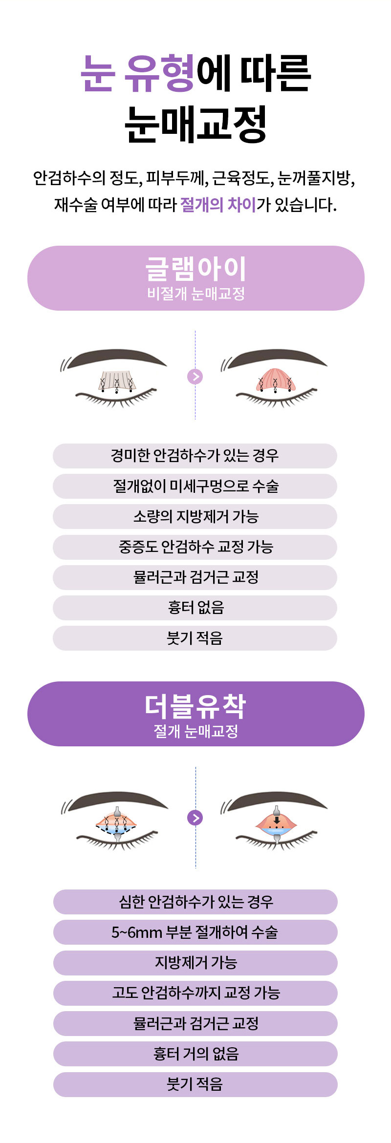광고랜딩