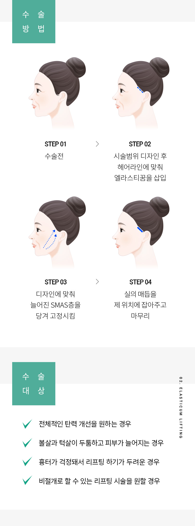 광고랜딩