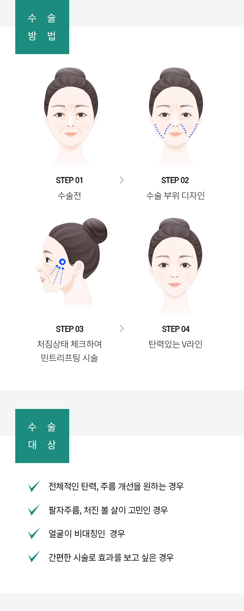 광고랜딩