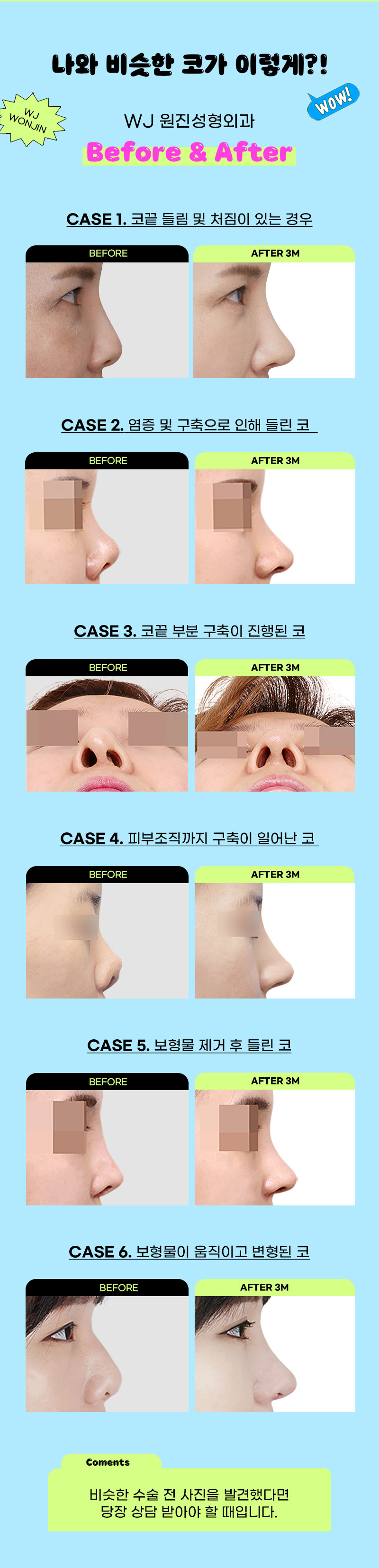 광고랜딩