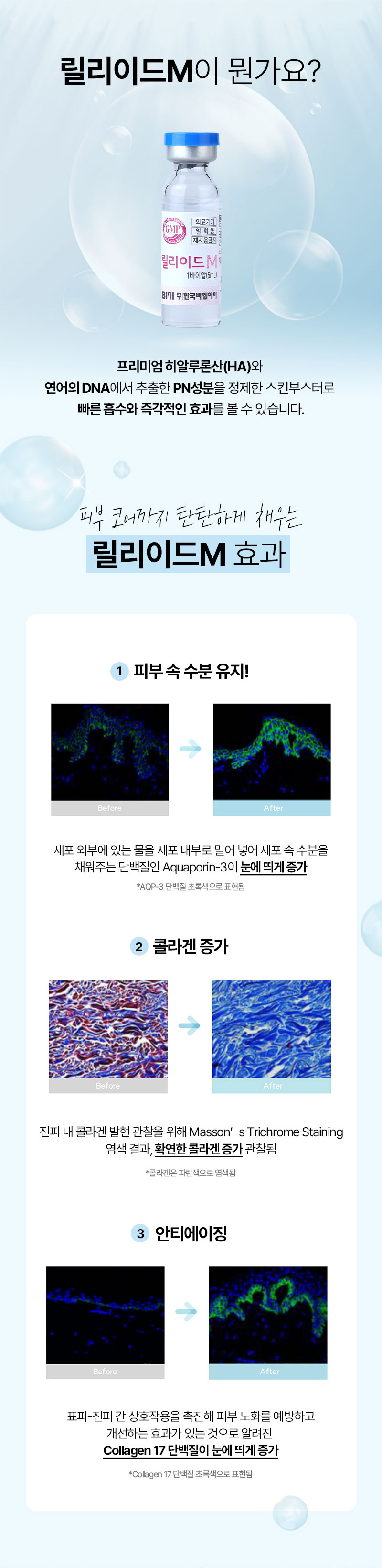 광고랜딩