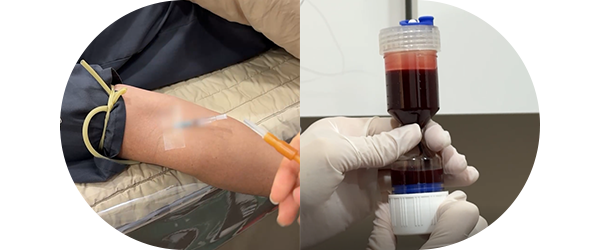 채혈 과정