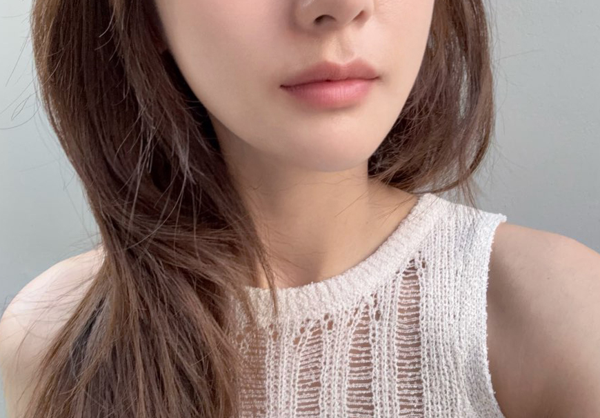 총총