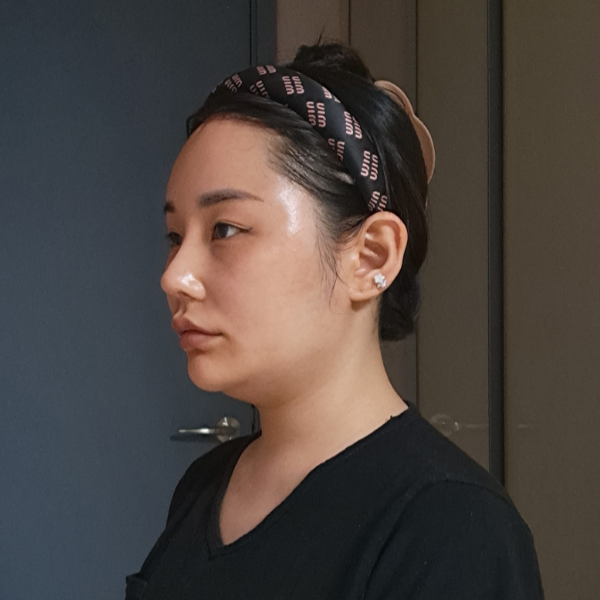 팔짝뛰엇